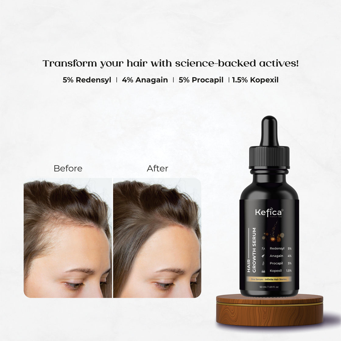 Hair Growth Serum with Redensyl, Anagain, Procapil & Kopexil